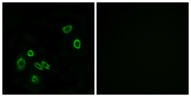 BRP44L Antibody - Immunofluorescence analysis of A549 cells, using BRP44L Antibody. The picture on the right is blocked with the synthesized peptide.