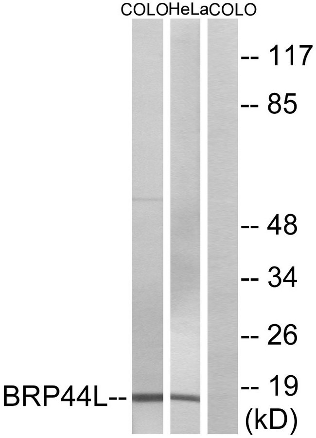 BRP44L Antibody - Western blot analysis of lysates from COLO and HeLa cells, using BRP44L Antibody. The lane on the right is blocked with the synthesized peptide.
