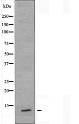 BRP44L Antibody - Western blot analysis of extracts of COLO cells using BRP44L antibody.