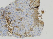 BRP44L Antibody - 1:100 staining mouse liver tissue by IHC-P. The sample was formaldehyde fixed and a heat mediated antigen retrieval step in citrate buffer was performed. The sample was then blocked and incubated with the antibody for 1.5 hours at 22°C. An HRP conjugated goat anti-rabbit antibody was used as the secondary.