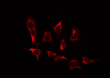 BRP44L Antibody - Staining COLO205 cells by IF/ICC. The samples were fixed with PFA and permeabilized in 0.1% Triton X-100, then blocked in 10% serum for 45 min at 25°C. The primary antibody was diluted at 1:200 and incubated with the sample for 1 hour at 37°C. An Alexa Fluor 594 conjugated goat anti-rabbit IgG (H+L) Ab, diluted at 1/600, was used as the secondary antibody.