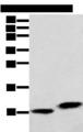 BRP44L Antibody - Western blot analysis of Hela cell and Human fetal liver tissue  using MPC1 Polyclonal Antibody at dilution of 1:250