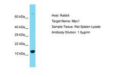 BRP44L Antibody -  This image was taken for the unconjugated form of this product. Other forms have not been tested.