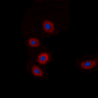 BRP44L Antibody - Immunofluorescent analysis of BRP44L staining in A549 cells. Formalin-fixed cells were permeabilized with 0.1% Triton X-100 in TBS for 5-10 minutes and blocked with 3% BSA-PBS for 30 minutes at room temperature. Cells were probed with the primary antibody in 3% BSA-PBS and incubated overnight at 4 deg C in a humidified chamber. Cells were washed with PBST and incubated with a DyLight 594-conjugated secondary antibody (red) in PBS at room temperature in the dark. DAPI was used to stain the cell nuclei (blue).