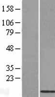 BRP44L Protein - Western validation with an anti-DDK antibody * L: Control HEK293 lysate R: Over-expression lysate