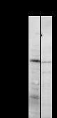 BRPF1 Antibody - Detection of BRPF1 by Western blot. Samples: Whole cell lysate from human HeLa (H, 50 ug) and rat NIH3T3 (M, 50 ug) cells. Predicted molecular weight: 138 kDa