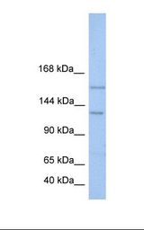 BRPF3 Antibody - Jurkat cell lysate. Antibody concentration: 1.0 ug/ml. Gel concentration: 6-18%.  This image was taken for the unconjugated form of this product. Other forms have not been tested.
