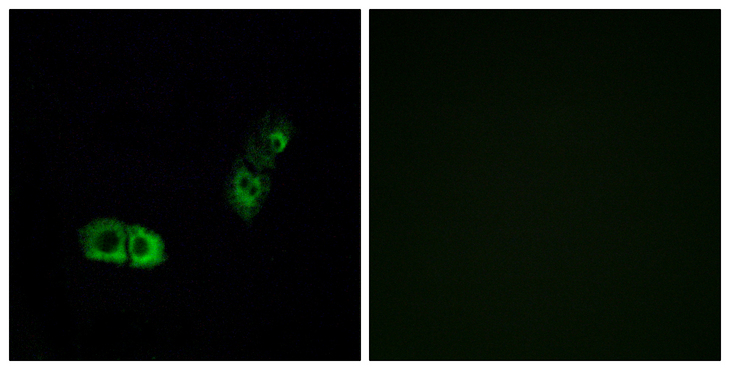BRS3 Antibody - Immunofluorescence analysis of A549 cells, using BRS3 Antibody. The picture on the right is blocked with the synthesized peptide.