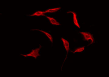 BRS3 Antibody - Staining HuvEc cells by IF/ICC. The samples were fixed with PFA and permeabilized in 0.1% Triton X-100, then blocked in 10% serum for 45 min at 25°C. The primary antibody was diluted at 1:200 and incubated with the sample for 1 hour at 37°C. An Alexa Fluor 594 conjugated goat anti-rabbit IgG (H+L) Ab, diluted at 1/600, was used as the secondary antibody.