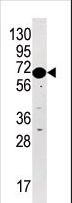 BRSK2 Antibody - Western blot of anti-STK29 Pabin HL60 cell line lysate (35 ug/lane). STK29(arrow) was detected using the purified antibody.