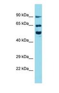 BRSK2 Antibody - Western blot of BRSK2 Antibody with human HT1080 Whole Cell lysate.  This image was taken for the unconjugated form of this product. Other forms have not been tested.