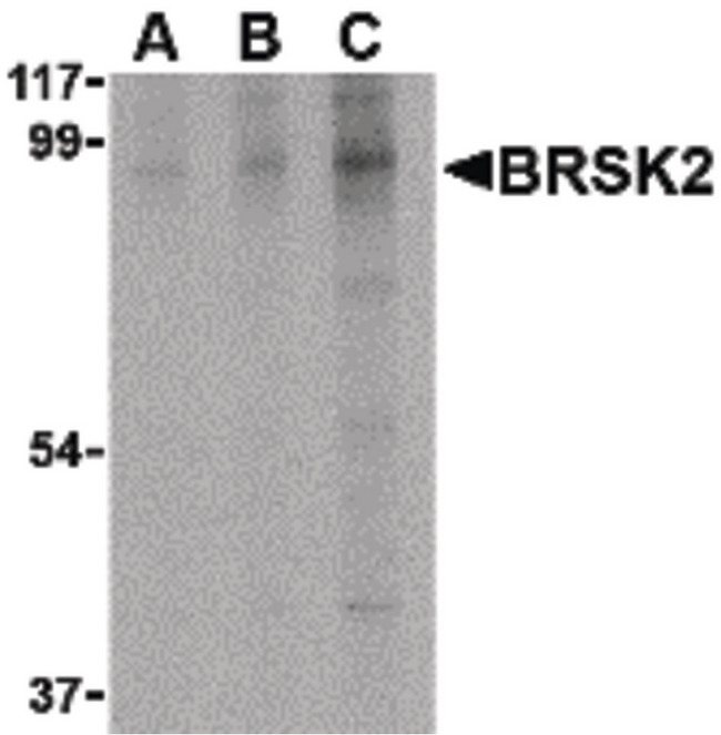 BRSK2 Antibody - Western blot of BRSK2 in human brain tissue lysate with BRSK2 antibody at (A) 0.5, (B) 1 and (C) 2 ug/ml.