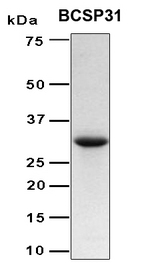 Brucella abortus 31 kDa immunogenic protein Protein