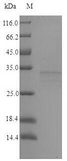 vjbR Protein - (Tris-Glycine gel) Discontinuous SDS-PAGE (reduced) with 5% enrichment gel and 15% separation gel.