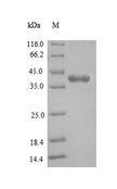 JTB / PAR Protein - (Tris-Glycine gel) Discontinuous SDS-PAGE (reduced) with 5% enrichment gel and 15% separation gel.
