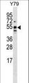 BRUNOL5 / CELF5 Antibody - BRUNOL5 Antibody western blot of Y79 cell line lysates (35 ug/lane). The BRUNOL5 Antibody detected the BRUNOL5 protein (arrow).