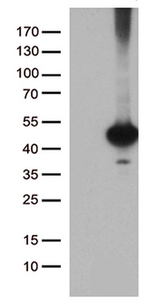 BRUNOL6 / CELF6 Antibody - HEK293T cells were transfected with the pCMV6-ENTRY control. (Left lane) or pCMV6-ENTRY CELF6. (Right lane) cDNA for 48 hrs and lysed. Equivalent amounts of cell lysates. (5 ug per lane) were separated by SDS-PAGE and immunoblotted with anti-CELF6. (1:2000)