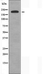 BRWD3 Antibody - Western blot analysis of extracts of COLO cells using BRWD3 antibody.