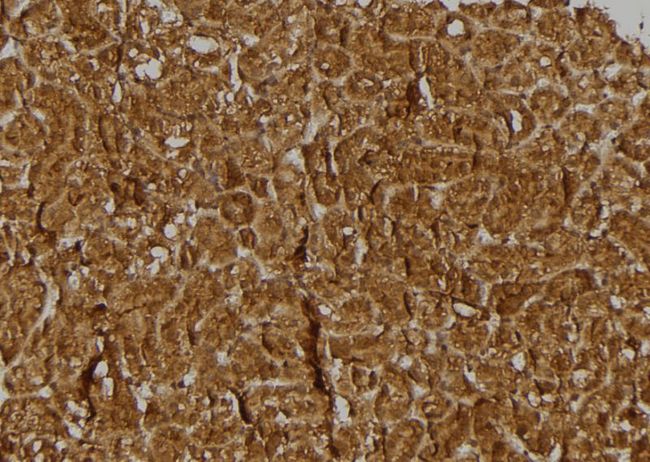 BRWD3 Antibody - 1:100 staining rat kidney tissue by IHC-P. The sample was formaldehyde fixed and a heat mediated antigen retrieval step in citrate buffer was performed. The sample was then blocked and incubated with the antibody for 1.5 hours at 22°C. An HRP conjugated goat anti-rabbit antibody was used as the secondary.