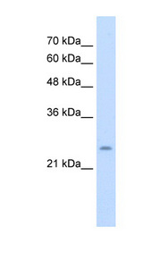 BRX / CHIC1 Antibody - CHIC1 / BRX antibody ARP44893_T100-NP_001034929-CHIC1(cysteine-rich hydrophobic domain 1) Antibody Western blot of Jurkat lysate.  This image was taken for the unconjugated form of this product. Other forms have not been tested.