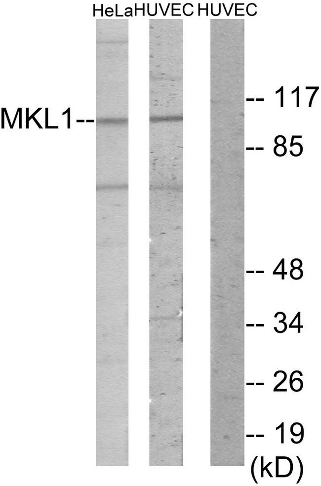 BSAC / MKL1 Antibody - Western blot analysis of lysates from HUVEC and HeLa cells, using MKL1 Antibody. The lane on the right is blocked with the synthesized peptide.