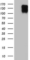 BSAC / MKL1 Antibody - HEK293T cells were transfected with the pCMV6-ENTRY control. (Left lane) or pCMV6-ENTRY MKL1. (Right lane) cDNA for 48 hrs and lysed. Equivalent amounts of cell lysates. (5 ug per lane) were separated by SDS-PAGE and immunoblotted with anti-MKL1.