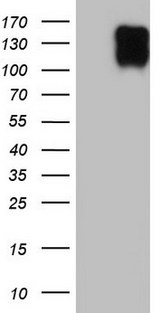 BSAC / MKL1 Antibody - HEK293T cells were transfected with the pCMV6-ENTRY control (Left lane) or pCMV6-ENTRY MKL1 (Right lane) cDNA for 48 hrs and lysed. Equivalent amounts of cell lysates (5 ug per lane) were separated by SDS-PAGE and immunoblotted with anti-MKL1.