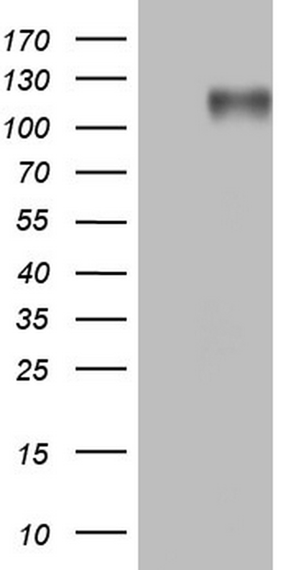 BSAC / MKL1 Antibody - HEK293T cells were transfected with the pCMV6-ENTRY control. (Left lane) or pCMV6-ENTRY MKL1. (Right lane) cDNA for 48 hrs and lysed. Equivalent amounts of cell lysates. (5 ug per lane) were separated by SDS-PAGE and immunoblotted with anti-MKL1.