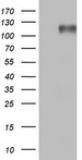 BSAC / MKL1 Antibody - HEK293T cells were transfected with the pCMV6-ENTRY control. (Left lane) or pCMV6-ENTRY MKL1. (Right lane) cDNA for 48 hrs and lysed. Equivalent amounts of cell lysates. (5 ug per lane) were separated by SDS-PAGE and immunoblotted with anti-MKL1.