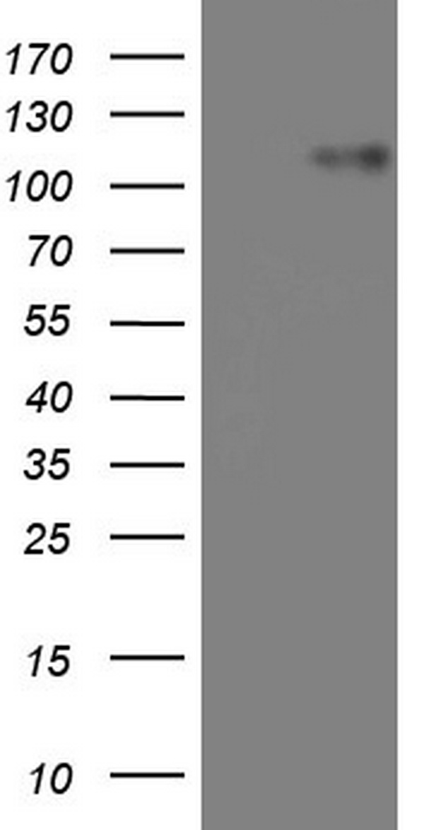 BSAC / MKL1 Antibody - HEK293T cells were transfected with the pCMV6-ENTRY control. (Left lane) or pCMV6-ENTRY MKL1. (Right lane) cDNA for 48 hrs and lysed. Equivalent amounts of cell lysates. (5 ug per lane) were separated by SDS-PAGE and immunoblotted with anti-MKL1.