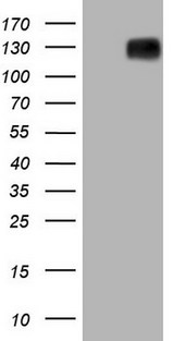 BSAC / MKL1 Antibody - HEK293T cells were transfected with the pCMV6-ENTRY control. (Left lane) or pCMV6-ENTRY MKL1. (Right lane) cDNA for 48 hrs and lysed. Equivalent amounts of cell lysates. (5 ug per lane) were separated by SDS-PAGE and immunoblotted with anti-MKL1.
