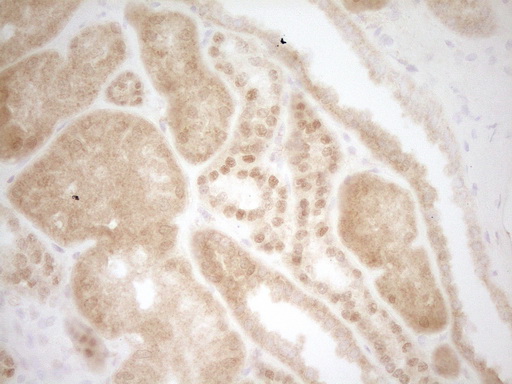 BSAC / MKL1 Antibody - Immunohistochemical staining of paraffin-embedded Human Kidney tissue within the normal limits using anti-MKL1 mouse monoclonal antibody. (Heat-induced epitope retrieval by 1 mM EDTA in 10mM Tris, pH8.5, 120C for 3min,