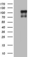 BSAC / MKL1 Antibody - HEK293T cells were transfected with the pCMV6-ENTRY control (Left lane) or pCMV6-ENTRY MKL1 (Right lane) cDNA for 48 hrs and lysed. Equivalent amounts of cell lysates (5 ug per lane) were separated by SDS-PAGE and immunoblotted with anti-MKL1.
