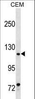 BSAC / MKL1 Antibody - MKL1 Antibody western blot of CEM cell line lysates (35 ug/lane). The MKL1 antibody detected the MKL1 protein (arrow).