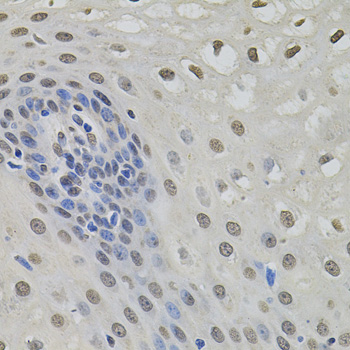 BSAC / MKL1 Antibody - Immunohistochemistry of paraffin-embedded human esophagus using MKL1 antibody (40x lens).
