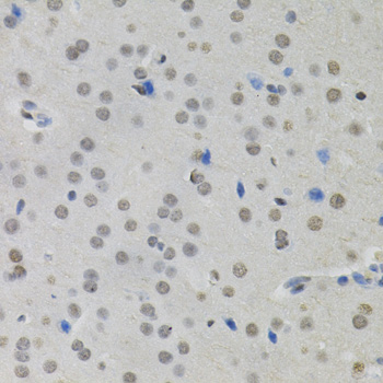 BSAC / MKL1 Antibody - Immunohistochemistry of paraffin-embedded mouse brain using MKL1 antibody (40x lens).