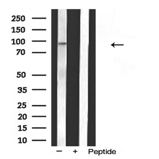 BSAC / MKL1 Antibody - Western blot analysis of MKL1 expression in HeLa cells extract