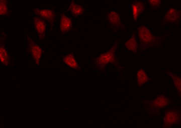 BSAC / MKL1 Antibody - Staining HuvEc cells by IF/ICC. The samples were fixed with PFA and permeabilized in 0.1% Triton X-100, then blocked in 10% serum for 45 min at 25°C. The primary antibody was diluted at 1:200 and incubated with the sample for 1 hour at 37°C. An Alexa Fluor 594 conjugated goat anti-rabbit IgG (H+L) Ab, diluted at 1/600, was used as the secondary antibody.