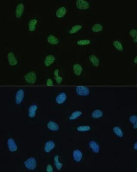 BSAC / MKL1 Antibody - Immunofluorescence analysis of U-2OS cells using MKL1 Polyclonal Antibody at dilution of 1:100 (40x lens).Blue: DAPI for nuclear staining.