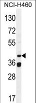 BSCL2 Antibody - BSCL2 Antibody western blot of NCI-H460 cell line lysates (35 ug/lane). The BSCL2 antibody detected the BSCL2 protein (arrow).