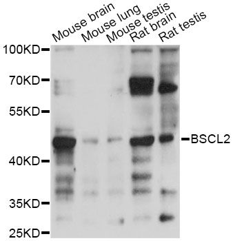BSCL2 Antibody - Western blot analysis of extracts of various cell lines, using BSCL2 antibody at 1:1000 dilution. The secondary antibody used was an HRP Goat Anti-Rabbit IgG (H+L) at 1:10000 dilution. Lysates were loaded 25ug per lane and 3% nonfat dry milk in TBST was used for blocking. An ECL Kit was used for detection and the exposure time was 5s.