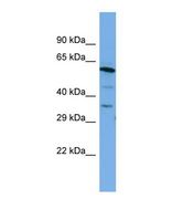 BSDC1 Antibody - Western blot of Human PANC1 Whole cell . BSDC1 antibody dilution 1.0 ug/ml.  This image was taken for the unconjugated form of this product. Other forms have not been tested.