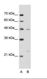 BSDC1 Antibody - A: Marker, B: Jurkat Cell Lysate.  This image was taken for the unconjugated form of this product. Other forms have not been tested.