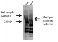 BSN / Bassoon Antibody - Immunoblot on rat and mouse brain lysates.