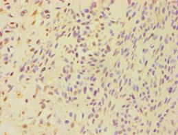 BSND / Barttin Antibody - Immunohistochemistry of paraffin-embedded human breast cancer using antibody at 1:100 dilution.