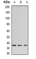 BSND / Barttin Antibody - Western blot analysis of Barttin expression in HEK293T (A); rat liver (B); rat kidney (C) whole cell lysates.