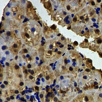 BSND / Barttin Antibody - Immunohistochemical analysis of Barttin staining in rat kidney formalin fixed paraffin embedded tissue section. The section was pre-treated using heat mediated antigen retrieval with sodium citrate buffer (pH 6.0). The section was then incubated with the antibody at room temperature and detected using an HRP conjugated compact polymer system. DAB was used as the chromogen. The section was then counterstained with hematoxylin and mounted with DPX.
