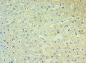 BST2 Antibody - Immunohistochemistry of paraffin-embedded human liver tissue using BST2 Antibody at dilution of 1:100