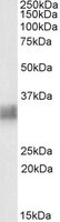 BST2 Antibody - BST2 antibody (0.3 ug/ml) staining of Human Spleen lysate (35 ug protein/ml in RIPA buffer). Primary incubation was 1 hour. Detected by chemiluminescence.