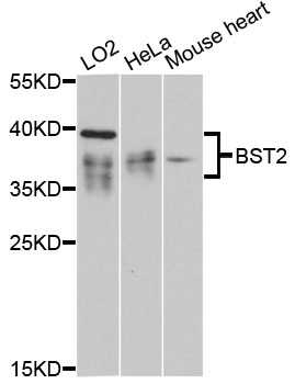 BST2 Antibody - Western blot analysis of extracts of various cell lines, using BST2 antibody at 1:3000 dilution. The secondary antibody used was an HRP Goat Anti-Rabbit IgG (H+L) at 1:10000 dilution. Lysates were loaded 25ug per lane and 3% nonfat dry milk in TBST was used for blocking. An ECL Kit was used for detection and the exposure time was 90s.